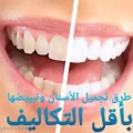 طرق تجميل الأسنان