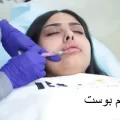 فوائد فيلر الشفايف